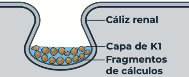 graphic_renal_calyx_es